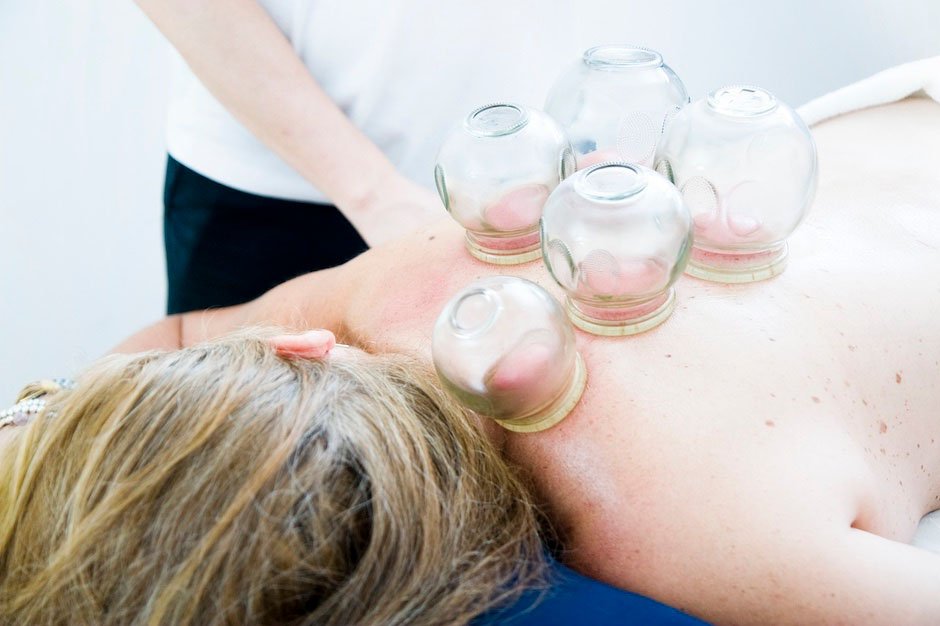 How Does Cupping Work