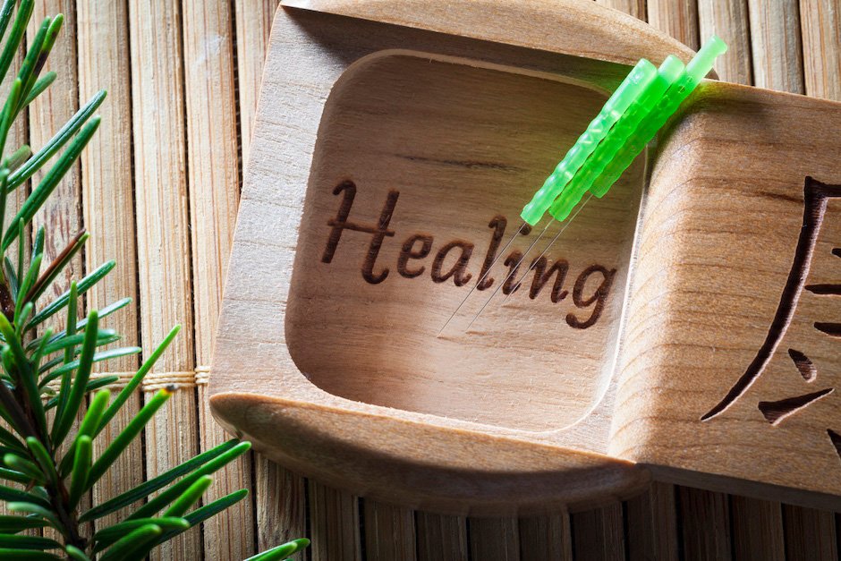 Acupuncture needles